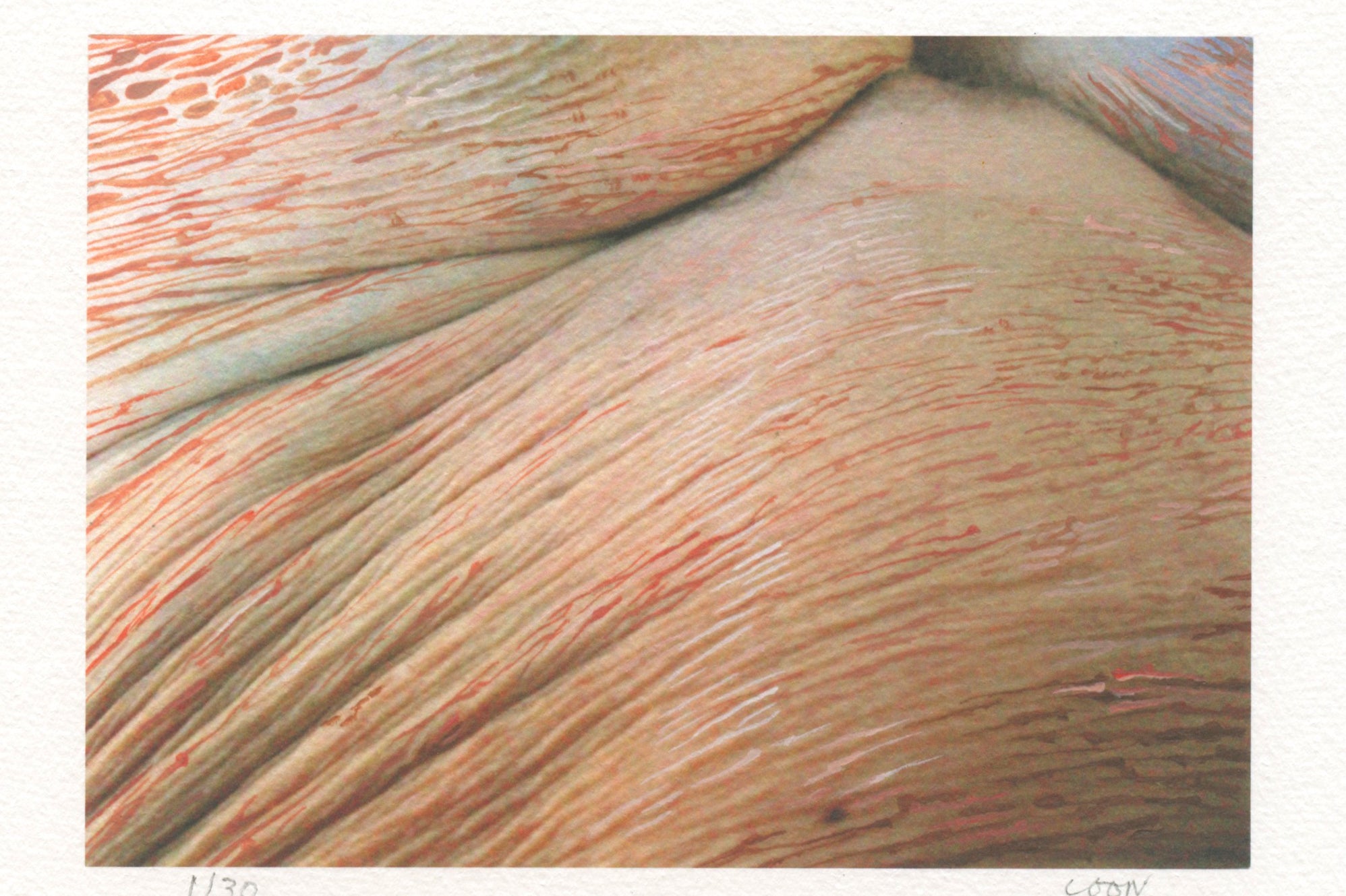 Caroline Coon - Skinscape, hand-signed print, AOAP Projects
